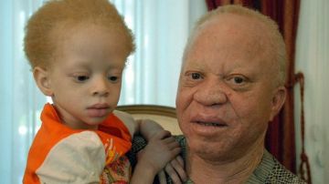 El músico africano lucha por la defensa de los albinos