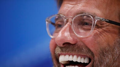 Klopp: 