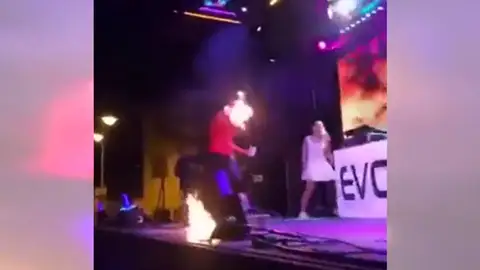 Una artista sufre quemaduras tras un accidente en un espectáculo con fuego Una artista sufre quemaduras tras un accidente en un espectáculo con fuego