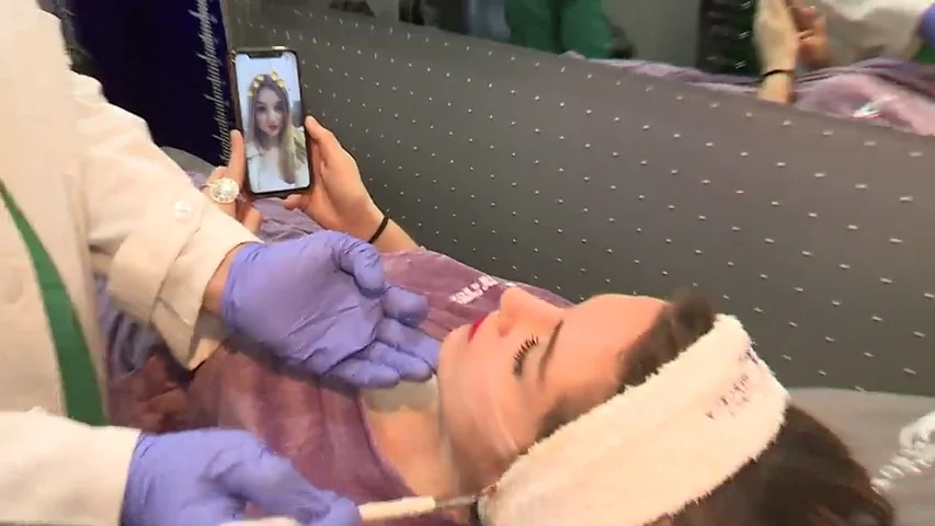 Los 'selfies' con filtros condicionan cada vez m&aacute;s las operaciones est&eacute;ticas en la cara 