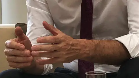Manos de Pedro Sánchez Manos de Pedro Sánchez