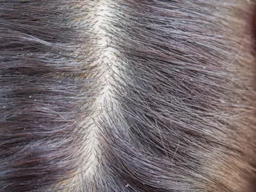 Pelo sucio Pelo sucio