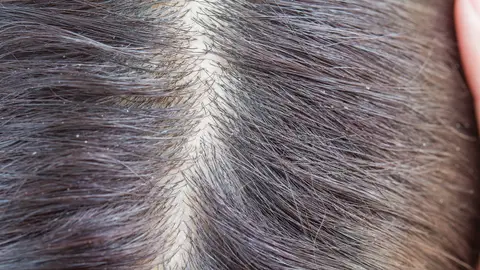 Pelo sucio Pelo sucio