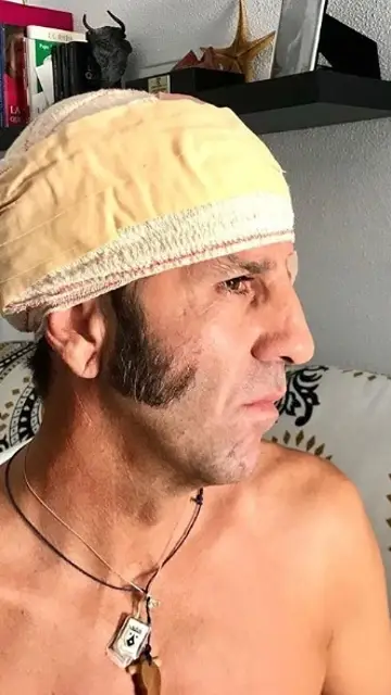 Padilla se recupera de su cogida Padilla se recupera de su cogida