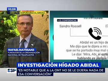 Rafael Matesanz, sobre el hígado de Abidal: "El trasplante pasó por los filtros del coordinador de trasplantes y comité ético" Rafael Matesanz, sobre el hígado de Abidal: "El trasplante pasó por los filtros del coordinador de trasplantes y comité ético"