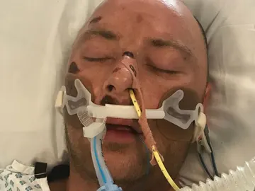 Imagen del hombre desconocido encontrado sin conocimiento en Londres Imagen del hombre desconocido encontrado sin conocimiento en Londres