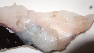 Una merluza infectada por anisakis