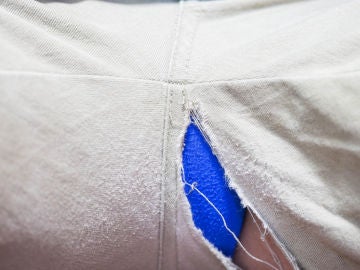 Roto en el pantalón Roto en el pantalón