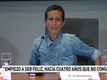 Una mujer con anorexia Una mujer con anorexia