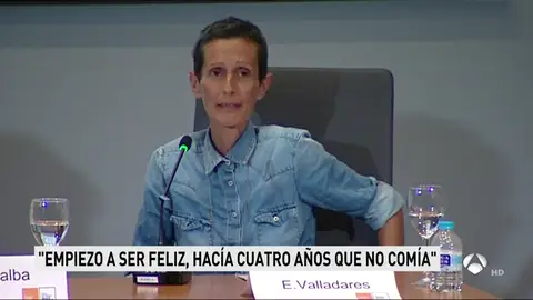 Una mujer con anorexia Una mujer con anorexia