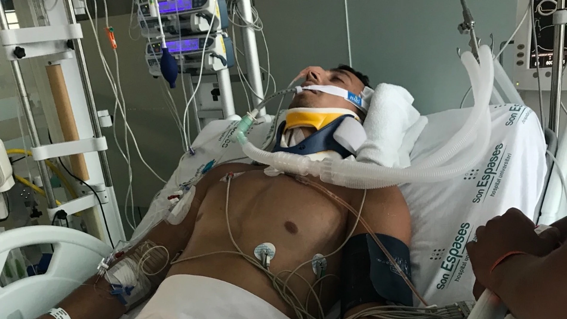 El turista británico ingresado en el hospital El turista británico ingresado en el hospital