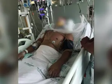 La novia del turista que se fracturó el cuello tras tirarse de cabeza a una piscina en Magaluf pide dinero para trasladarlo a su país La novia del turista que se fracturó el cuello tras tirarse de cabeza a una piscina en Magaluf pide dinero para trasladarlo a su país