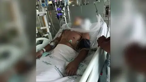 La novia del turista que se fracturó el cuello tras tirarse de cabeza a una piscina en Magaluf pide dinero para trasladarlo a su país La novia del turista que se fracturó el cuello tras tirarse de cabeza a una piscina en Magaluf pide dinero para trasladarlo a su país