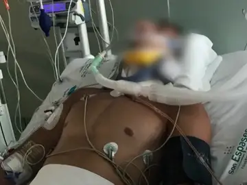La pareja del turista británico que se fracturó el cuello en una piscina de Magaluf pide dinero para su traslado La pareja del turista británico que se fracturó el cuello en una piscina de Magaluf pide dinero para su traslado