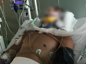 La pareja del turista británico que se fracturó el cuello en una piscina de Magaluf pide dinero para su traslado La pareja del turista británico que se fracturó el cuello en una piscina de Magaluf pide dinero para su traslado