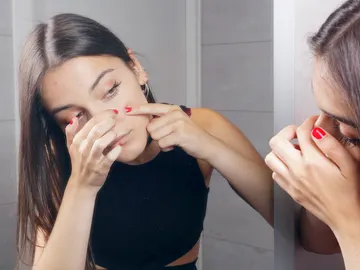 Chica quitándose puntos negros Chica quitándose puntos negros