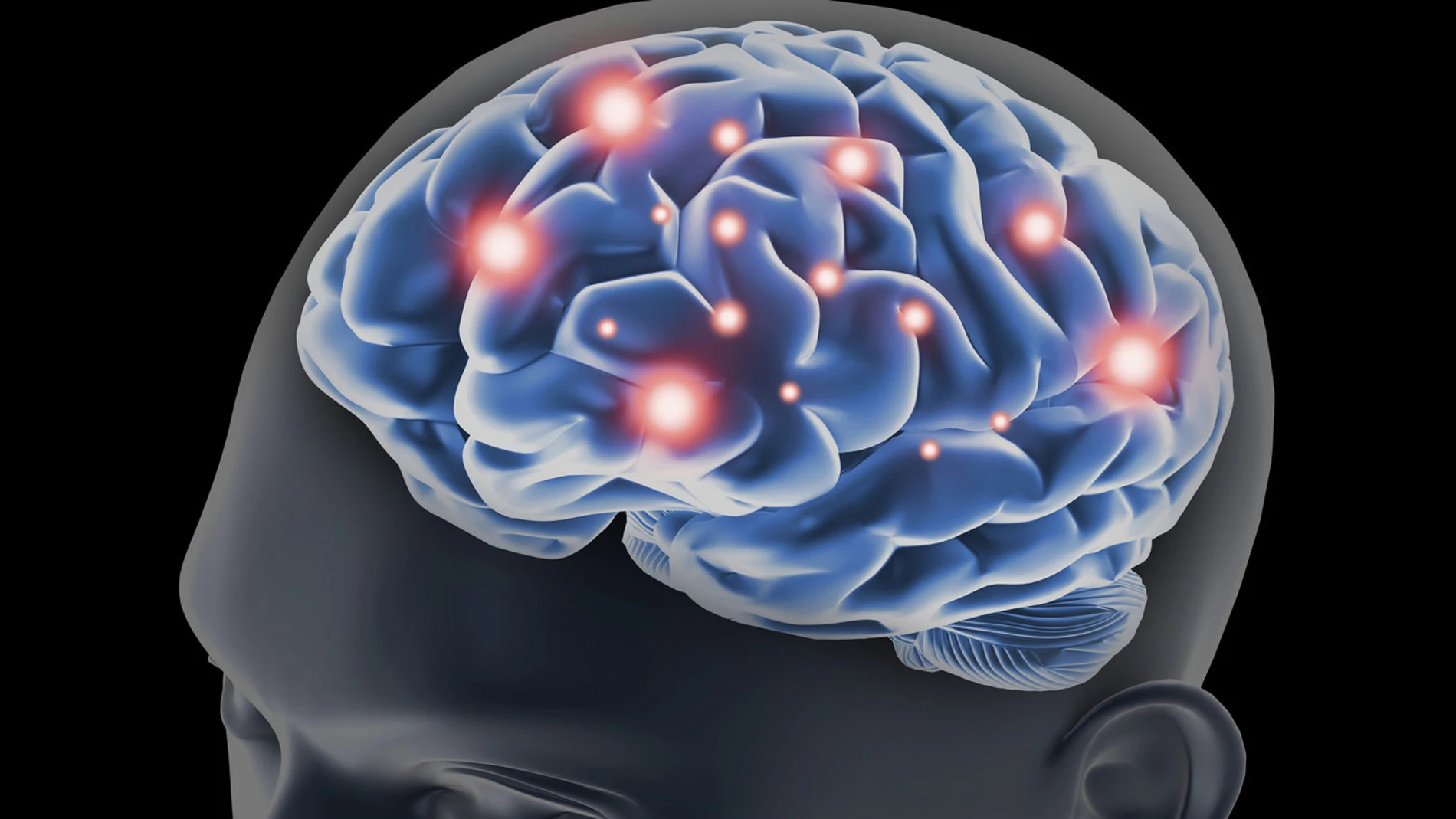 Cerebro Cerebro