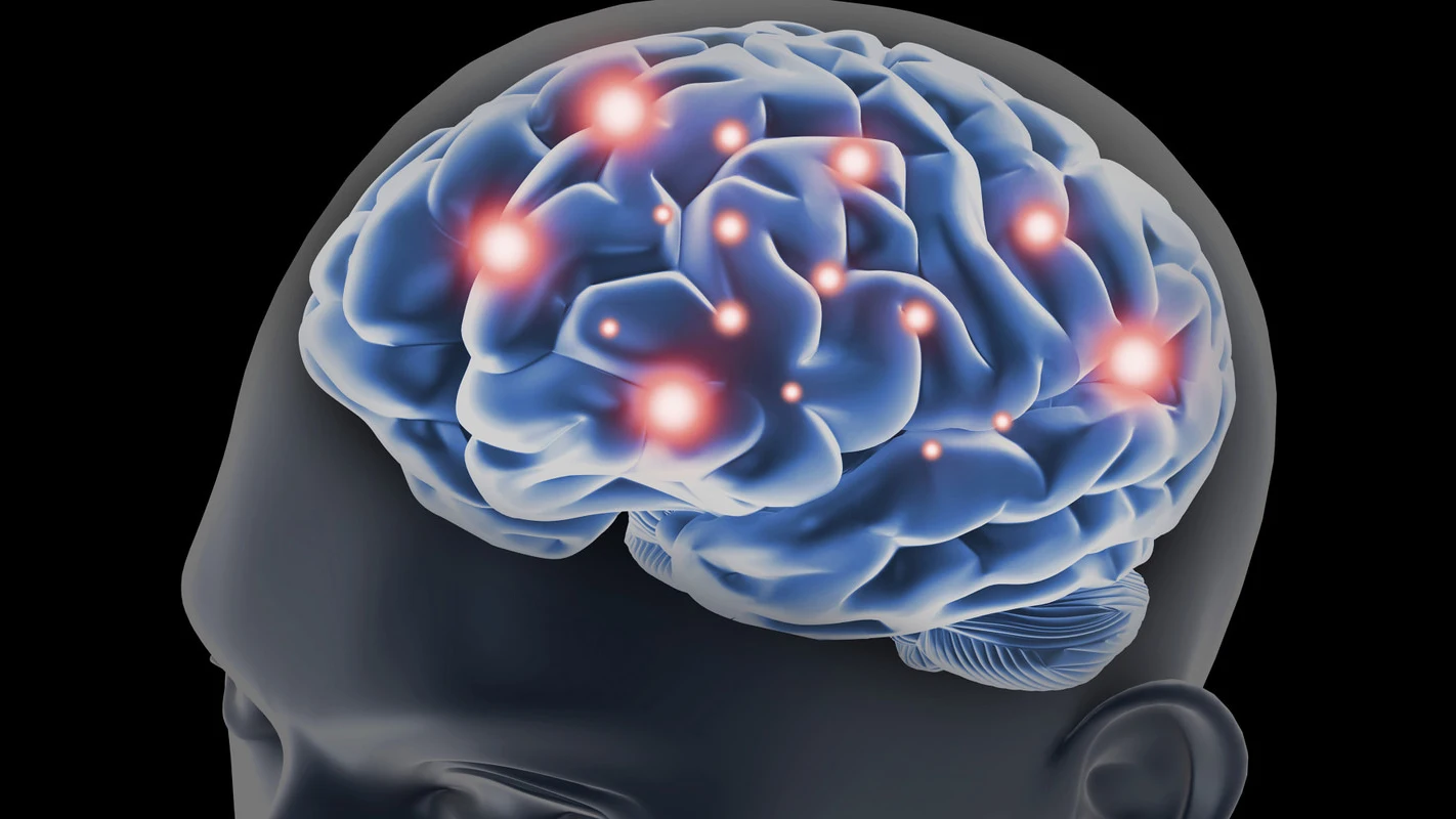 Cerebro Cerebro