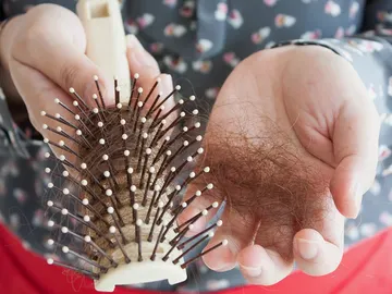 Caída del cabello Caída del cabello