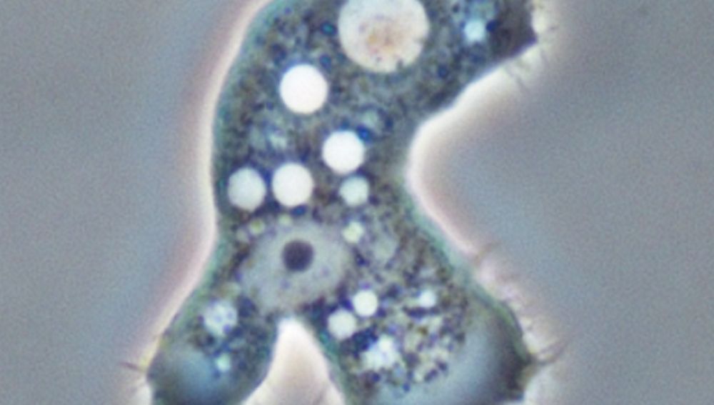 Parásito acanthamoeba