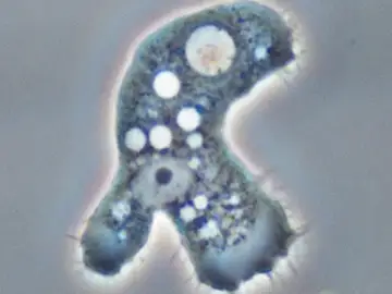 Parásito acanthamoeba Parásito acanthamoeba