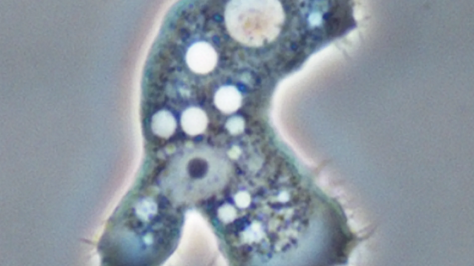 Parásito acanthamoeba Parásito acanthamoeba