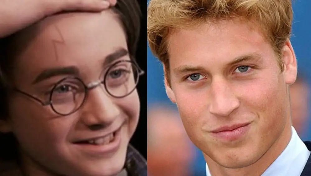 Cicatriz de 'Harry Potter' y el Duque de Cambridge