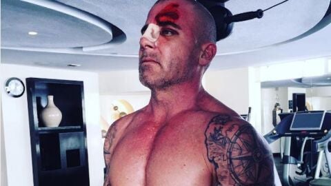 Dominic Purcell