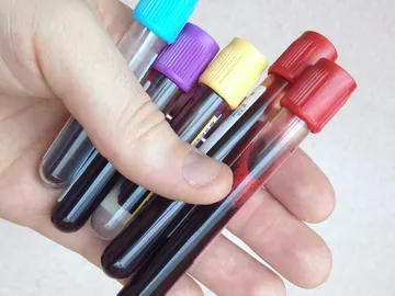 Transfusión de sangre Transfusión de sangre