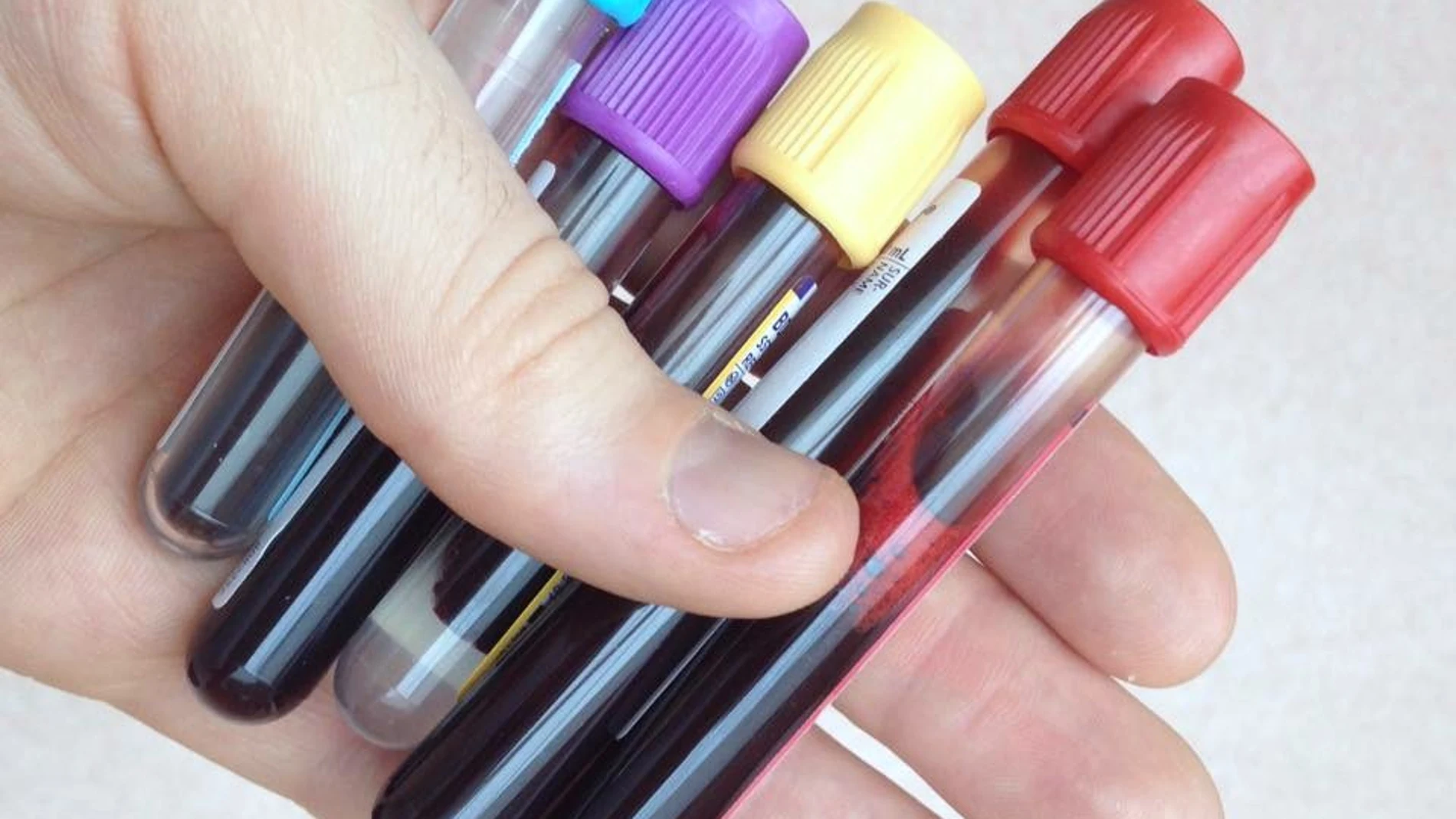 Transfusión de sangre Transfusión de sangre