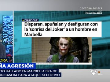 Brutalidad en Marbella: Desfiguran a un británico con 'La sonrisa del Joker' y le disparan en manos y pies
