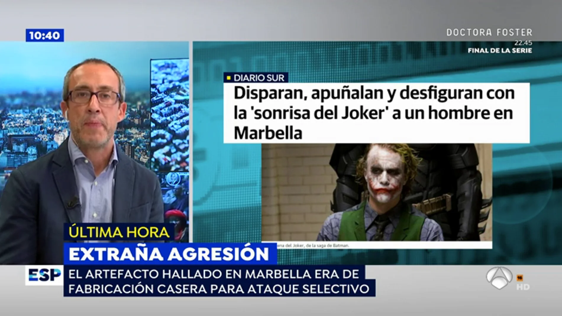 Brutalidad en Marbella: Desfiguran a un británico con 'La sonrisa del Joker' y le disparan en manos y pies