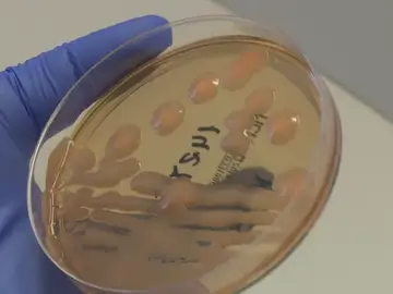 La sepsis, la infección bacteriana frecuente pero desconocida La sepsis, la infección bacteriana frecuente pero desconocida