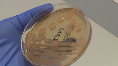 La sepsis, la infecci&oacute;n bacteriana frecuente pero desconocida