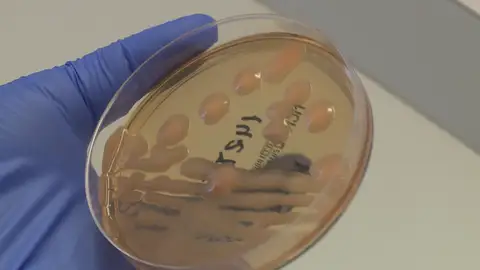 La sepsis, la infección bacteriana frecuente pero desconocida La sepsis, la infección bacteriana frecuente pero desconocida