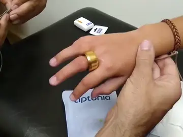 El ingenioso método con el que los bomberos logran sacar un anillo a un niño El ingenioso método con el que los bomberos logran sacar un anillo a un niño