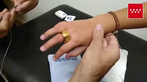 El ingenioso método con el que los bomberos logran sacar un anillo a un niño El ingenioso método con el que los bomberos logran sacar un anillo a un niño de nueve años