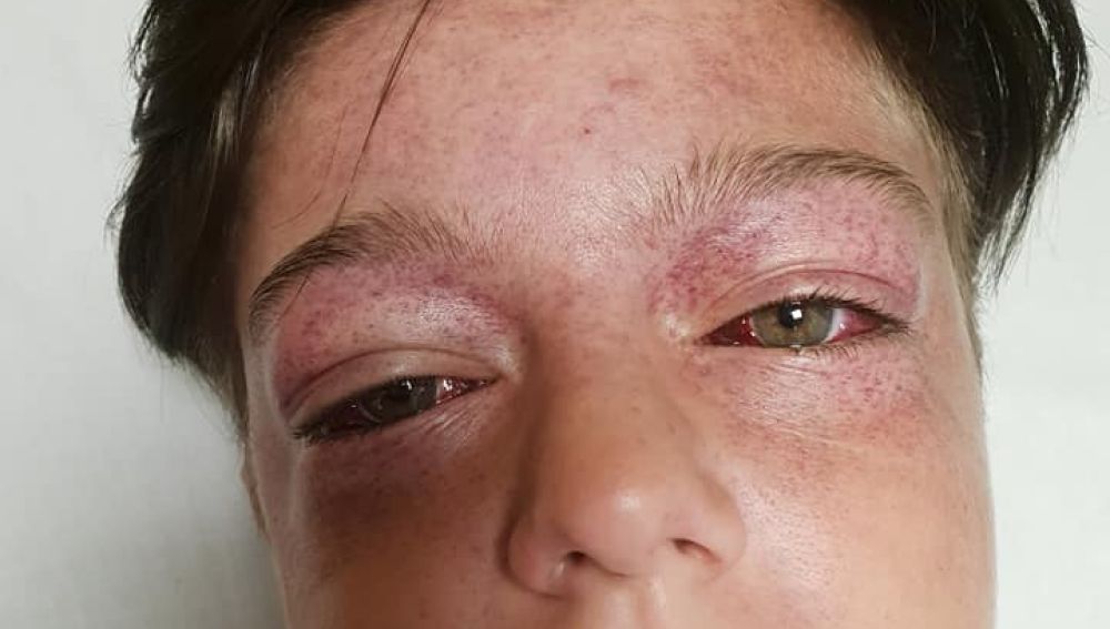 El menor tras participar en el reto viral