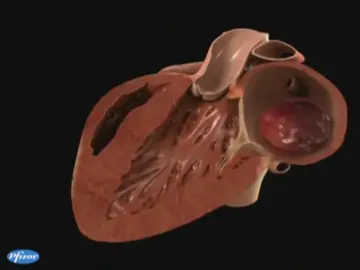 La creación de entornos saludables para combatir las enfermedades cardiovasculares La creación de entornos saludables para combatir las enfermedades cardiovasculares