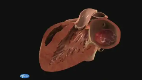 La creación de entornos saludables para combatir las enfermedades cardiovasculares La creación de entornos saludables para combatir las enfermedades cardiovasculares