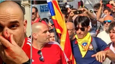 El policía agredido y su agresor El policía agredido y su agresor