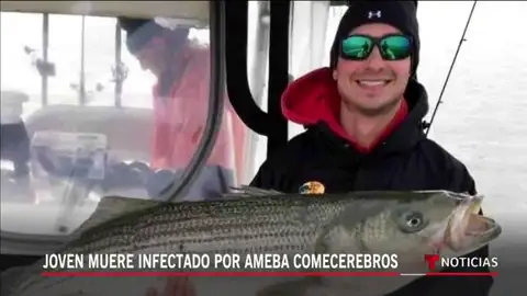 Un surfista muere en Texas por una 'ameba come-cerebros' tras bañarse en una piscina Un surfista muere en Texas por una 'ameba come-cerebros' tras bañarse en una piscina