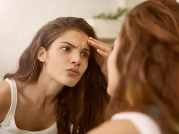 Mujer con manchas en la cara Mujer con manchas en la cara