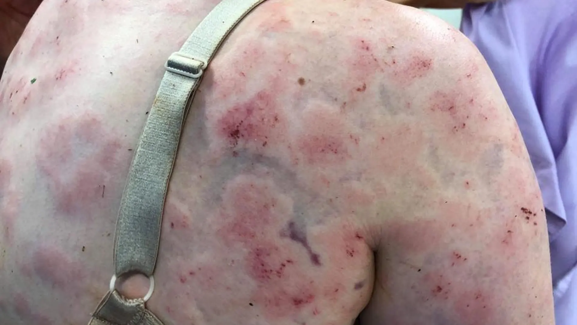 La heridas que sufrió la mujer La heridas que sufrió la mujer