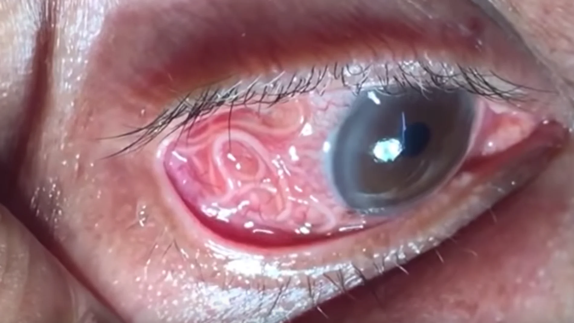 imagen del ojo imagen del ojo