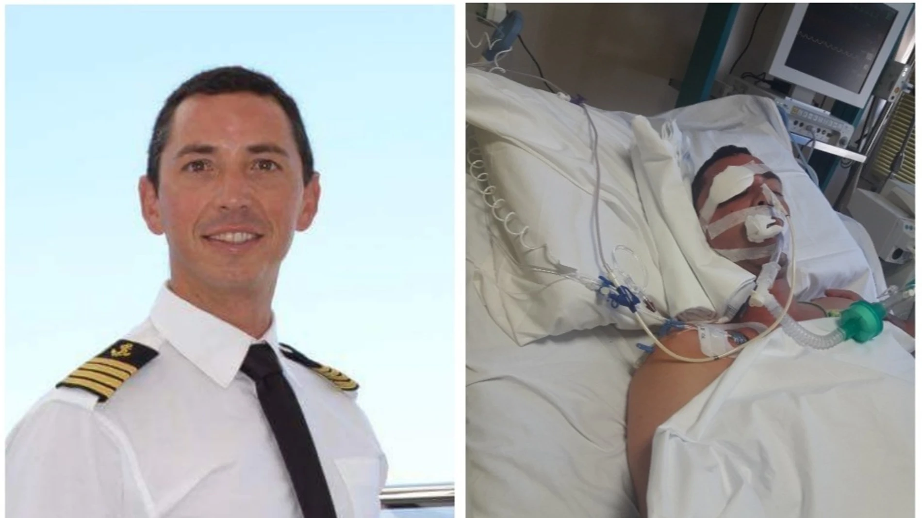 Imagen del joven español agredido en Italia Imagen del joven español agredido en Italia