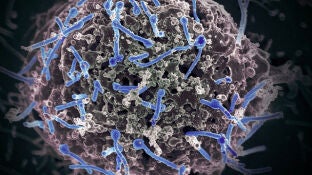 Imagen del virus del &Eacute;bola aislado de una muestra de sangre 