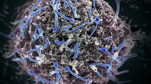 Imagen del virus del Ébola aislado de una muestra de sangre Imagen del virus del Ébola aislado de una muestra de sangre