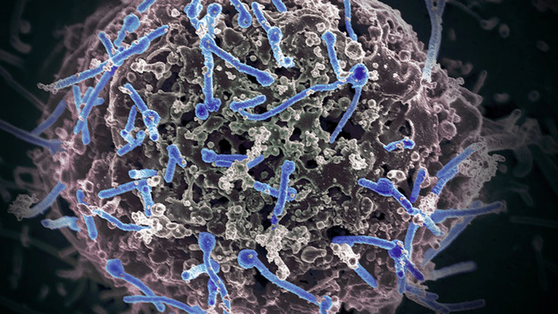 Imagen del virus del Ébola aislado de una muestra de sangre Imagen del virus del Ébola aislado de una muestra de sangre