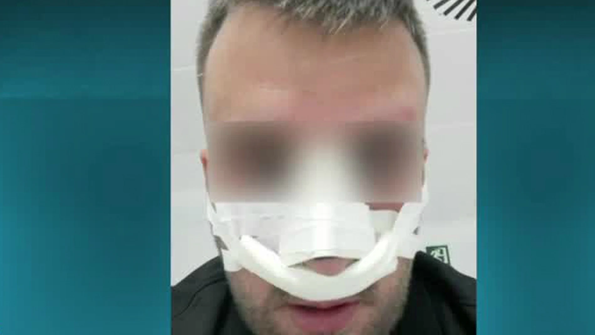 El entrenador del equipo alevín del Meliana, tras ser agredido El entrenador del equipo alevín del Meliana, tras ser agredido